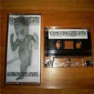 Regurgitacion - Malformacion Genetica Introfetal mp3 album