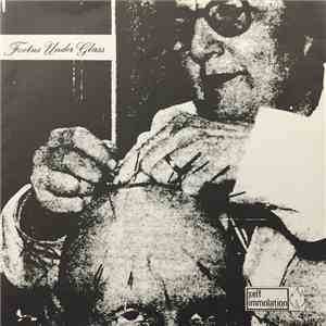 Foetus Under Glass - Spite Your Face / OKFM mp3 album