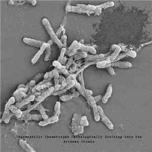 DxTxS - Thermophilic Chemotrophs Pathologically Evolving Into The Archean Strain mp3 album