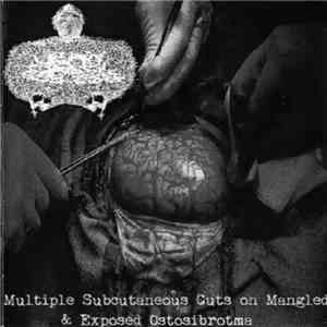 Urinary Tract Infection From Severe Pus Clots / WxIxAxPxWxAxCx - Multiple Subcutaneous Cuts On Mangled & Exposed Ostosibrotma / 1 Week Pregnancy: Investigating The Causes Of Death mp3 album