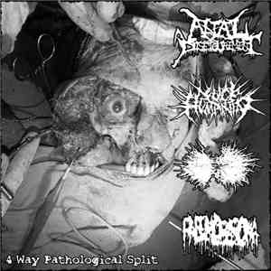 Anal Disfigurement / Fuck Humanity / Infected Gastroenteritis / Pneumoblastoma - 4 Way Pathological Split mp3 album