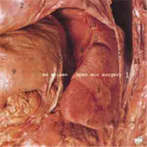 Mr. Spleen - Open Mic Surgery mp3 album
