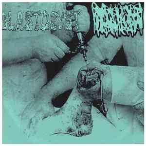 Blastocyst  / Hydrocephalus - Split mp3 album