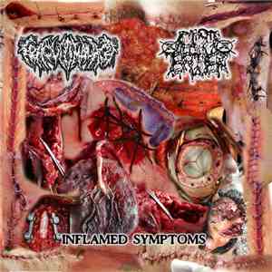 Traqueomalácia / Cyst Eater - Inflamed Symptoms mp3 album