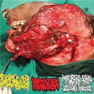 Dissolved  / Hydrocephalus / Perforated Bowel Syndrome With Oozing Faeces - Dissolved / Hydrocephalus / Perforated Bowel Syndrome With Oozing Faeces mp3 album